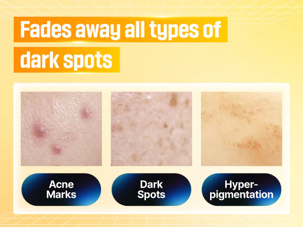 Numbuzin No.5+ Glutathione Vitamin Concentrated Serum, Glutathione, Vitamin C |Hyperpigmentation| Suitable for Sensitive Skin, Korean Skincare |