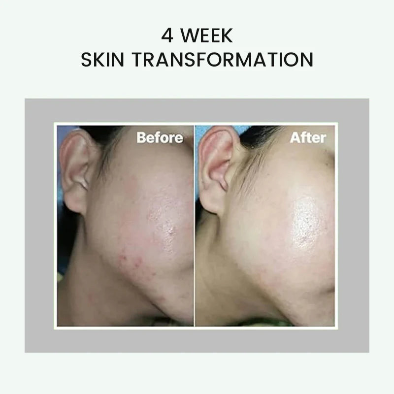 celimax Pore + Dark Spot Brightening Cream 35ml