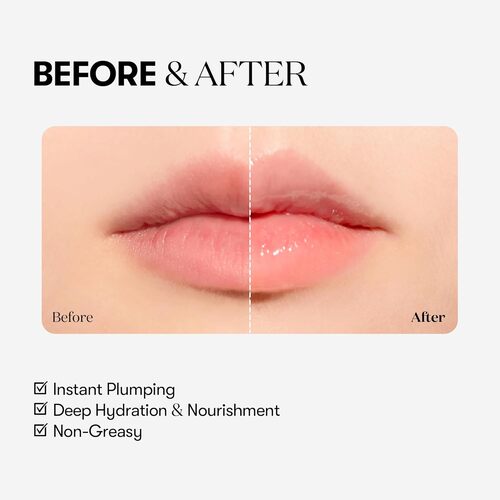 VT Cosmetics Reedle Shot Lip Plumper Beginner