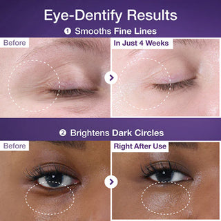 numbuzin No.9 NAD Retinol Volumetox Eye Cream 10ml (botox cream)