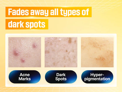 Numbuzin No.5+ Glutathione Vitamin Concentrated Serum, Glutathione, Vitamin C |Hyperpigmentation| Suitable for Sensitive Skin, Korean Skincare |