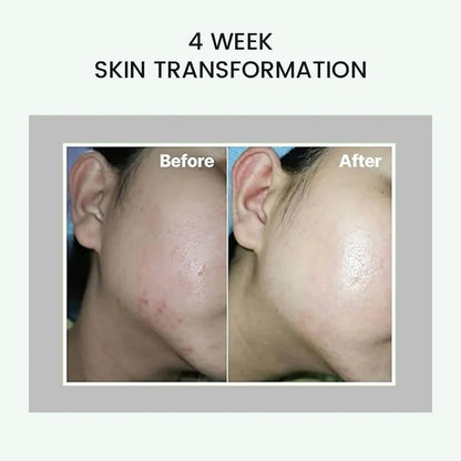 celimax Pore + Dark Spot Brightening Cream 35ml