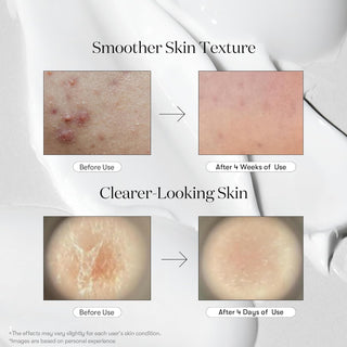 VT COSMETICS CICA Reedle Shot 300 (50ml)