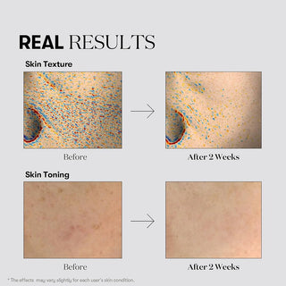 VT COSMETICS TX Toning Daily Mask 30 Sheets, Tranexamic Acid, Niacinamide, Glutathione for Acne Scars, Dark Spots, Sun Spots, Hydrating & Glowing Facial Mask, Fragrance-Free,