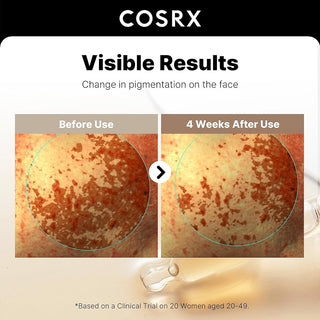 COSRX 2% Alpha Arbutin Discoloration Care Face Serum with Niacinamide, Glutathione & Tranexamic Acid, 1.7 fl oz