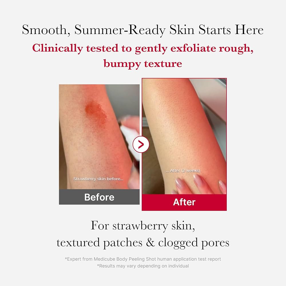 medicube Red Body Peeling Shot, AHA + BHA Exfoliating Body Spray for Summer-Ready Smooth Skin, Treats Strawberry Skin, Bumps & Breakouts, 3.88 oz