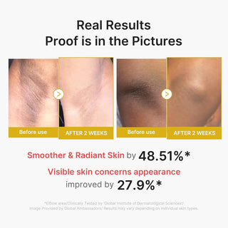 medicube Body Peel Shot with Kojic Acid and Turmeric 280 ml