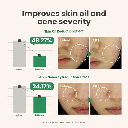 AXIS-Y Spot The Difference Blemish Spot Treatment - 4-Terpineol 2% Niacinamide AHA BHA Soothes Breakouts & Skin Barrier Repair - Vegan Korean Skin Care Face Serum (0.50 fl. oz.)