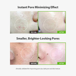 SUNGBOON EDITOR Green Tomato Pore Lifting Ampoule (OLIVE YOUNG set) 30ml+30ml+10ml (70ml)