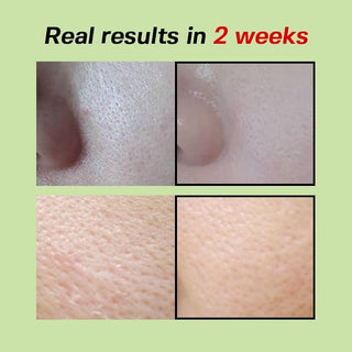 SUNGBOON EDITOR Green Tomato Pore Lifting Ampoule (OLIVE YOUNG set) 30ml+30ml+10ml (70ml)