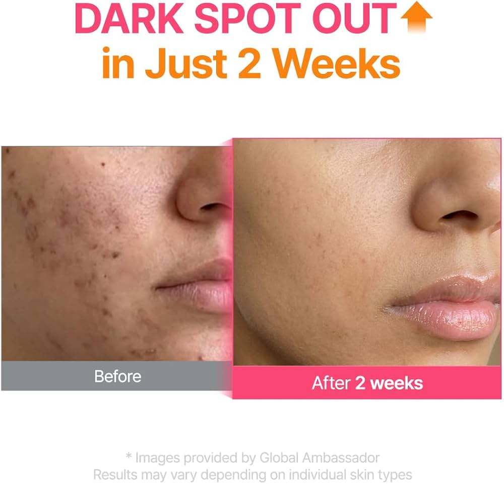 PURITO TXA 6% + Niacinamide 10% Facial Serum | for Dark Spots, Hyperpigmentation, Uneven Skin Tone | High-Concentration Tranexamic Acid | Korean Skincare, 30mL