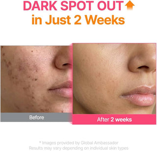 PURITO TXA 6% + Niacinamide 10% 30mL