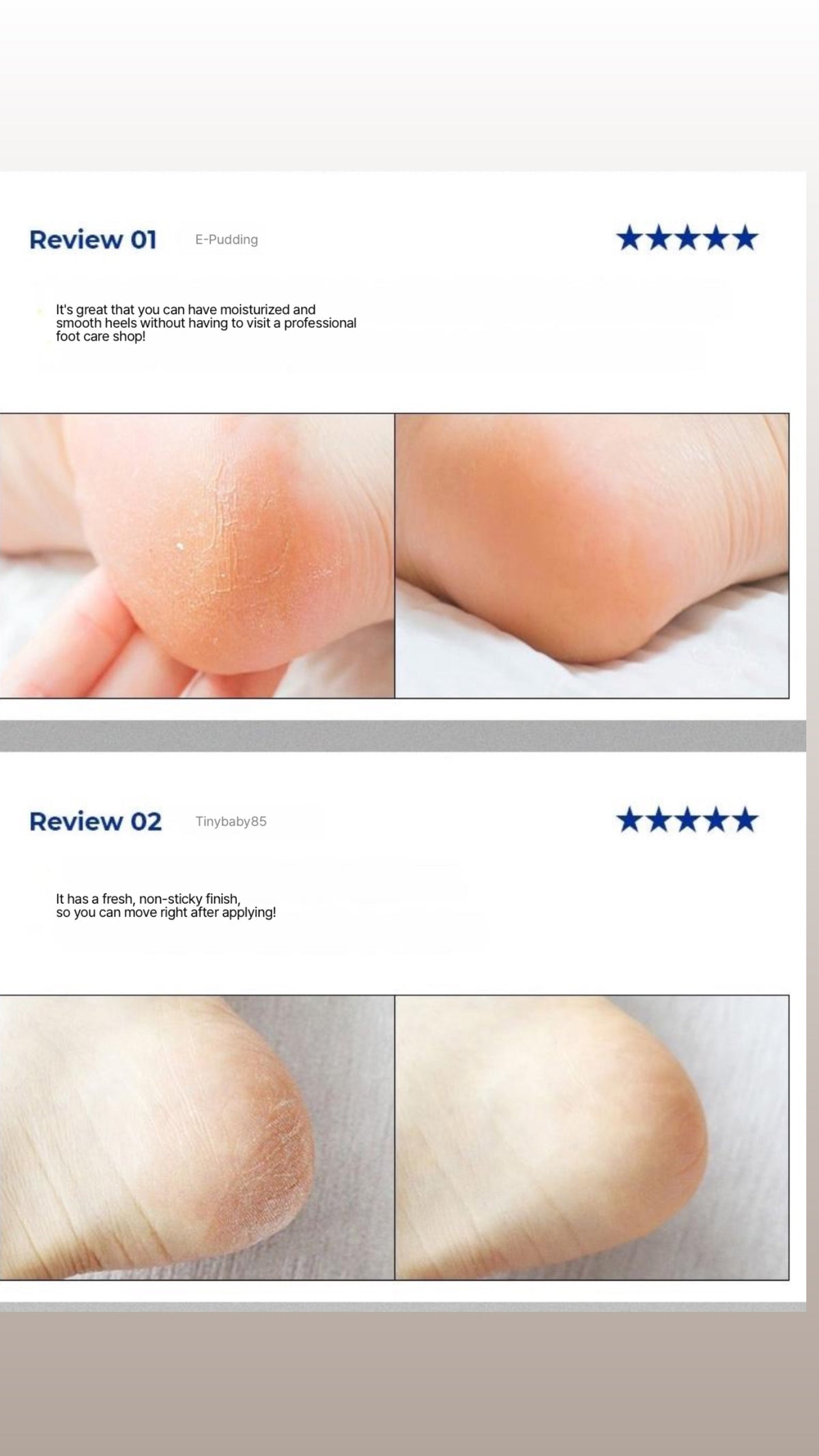 MEDI-PEEL EGF Scaling Moisture Foot Cream 130g