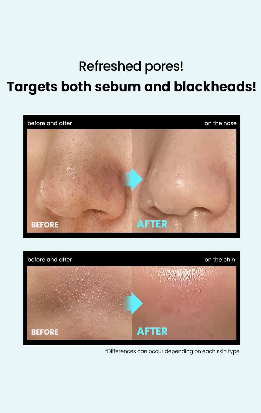 ilso Super Melting Sebum Softener 150ml Set (+Cotton Pad 40P+Pore Tension Mask Sheet 1ea)