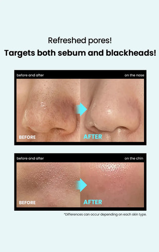 ilso Super Melting Sebum Softener 150ml Set (+Cotton Pad 40P+Pore Tension Mask Sheet 1ea)