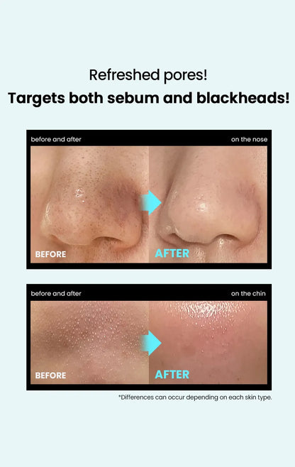 ilso Super Melting Sebum Softener 150ml Set (+Cotton Pad 40P+Pore Tension Mask Sheet 1ea)