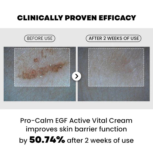 PRO-CALM EGF ACTIVE VITAL CREAM 20ML
