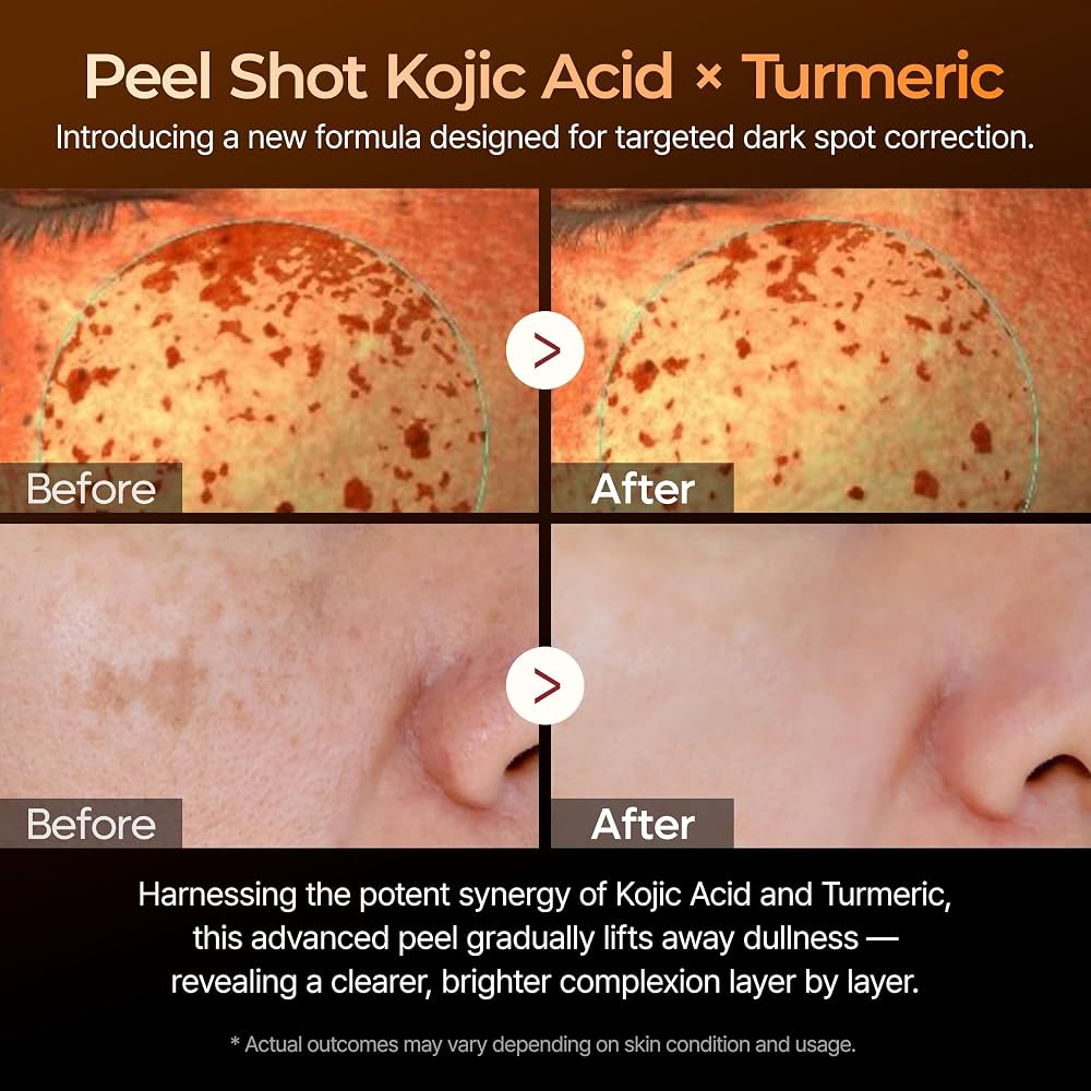 Dr. Melaxin Peel Shot Kojic Acid Turmeric Serum 80ml