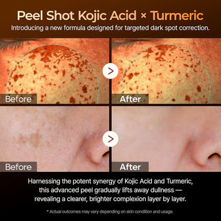 Dr. Melaxin Peel Shot Kojic Acid Turmeric Serum 80ml