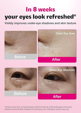 ISOI blemish care Brightening eye Wrinkle Patch 1 Set) 3 pieces only (packet from olive young box)
