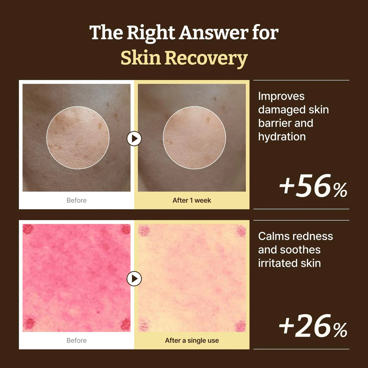 Dr rejual Advanced PDRN Repair Cream 20g