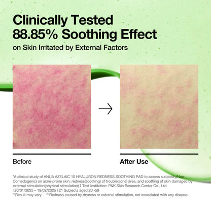 ANUA AZELAIC 10 HYALURON REDNESS SOOTHING 90 PAD