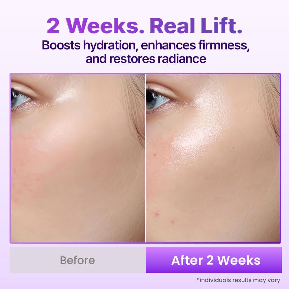 BIOHEAL BOH Probioderm 3D Lifting Cream Mist 3.38 fl oz | Korean Face Mist with Cream-Like Hydration for Instant Glow, Firm-Looking Skin & On-the-Go Refresh