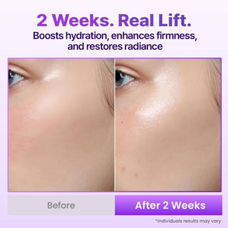 BIOHEAL BOH Probioderm 3D Lifting Cream Mist 3.38 fl oz