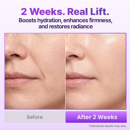 BIOHEAL BOH Probioderm 3D Lifting Cream Mist 3.38 fl oz | Korean Face Mist with Cream-Like Hydration for Instant Glow, Firm-Looking Skin & On-the-Go Refresh
