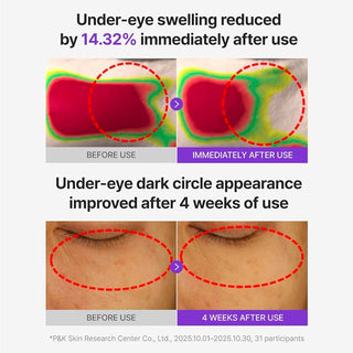 Centellian 24 360 Shot PDRN Glowing Eye Patch, Dark Circles (6 Pairs)