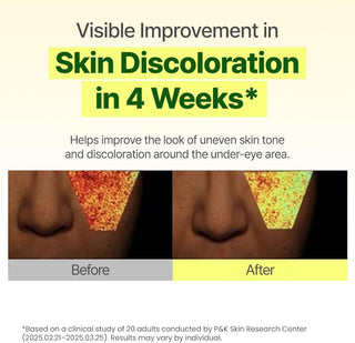GOODAL Green Tangerine Vitamin C Dark Circle Eye Cream | Intensive Dark Circle Relief and Elasticity Treatment, Gentle, Non-irritating, Anti-Aging and Anti-Wrinkle Care 30ml