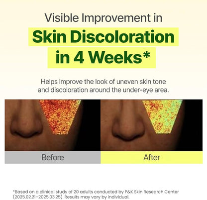 GOODAL Green Tangerine Vitamin C Dark Circle Eye Cream | Intensive Dark Circle Relief and Elasticity Treatment, Gentle, Non-irritating, Anti-Aging and Anti-Wrinkle Care 30ml