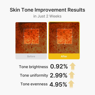 medicube Capsule Cream with Kojic Acid & Turmeric for Uneven Skin Tone 53g