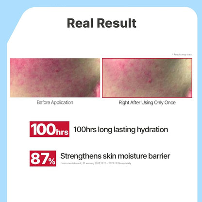 Illiyoon Ceramide Ato Lotion | Lightweight Moisturizer for Dry & Sensitive Skin, Barrier Repair for Face and Body, Mild for Babies, Vegan Certified, Korean Skincare, 334 ml