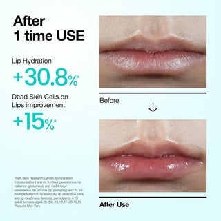 Anua PDRN Lip Serum, 0.33 fl.oz 10 ml