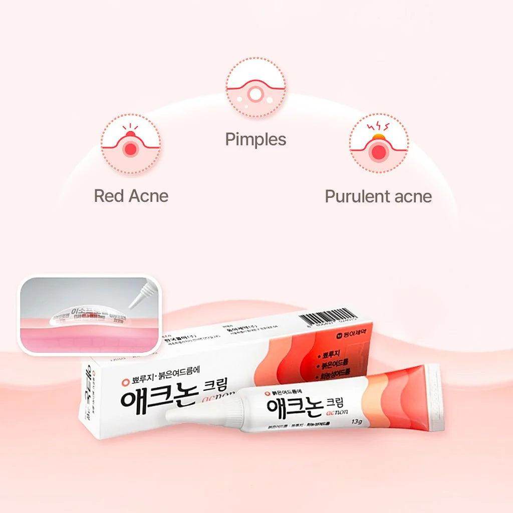 DONG-A Acnon Cream 13g Korean Pharmacy