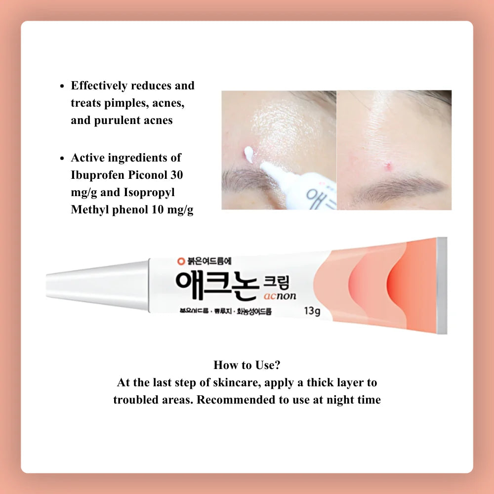 DONG-A Acnon Cream 13g Korean Pharmacy