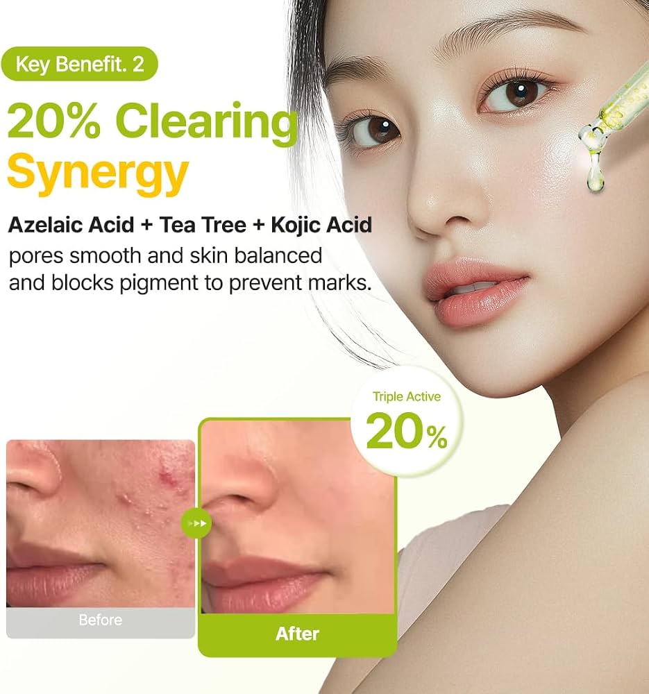PURITO Azelaic Acid 10% + Kojic Acid + Tea Tree Facial Serum | for Blemish-Prone, Oily & Sensitive Skin | Redness Relief | Korean Skincare, 30mL 1.01 fl.oz