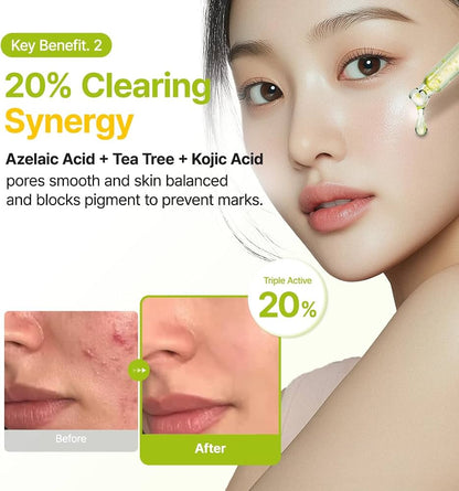 PURITO Azelaic Acid 10% + Kojic Acid + Tea Tree Facial Serum | for Blemish-Prone, Oily & Sensitive Skin | Redness Relief | Korean Skincare, 30mL 1.01 fl.oz